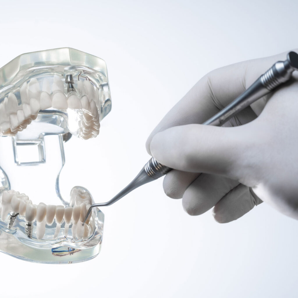 Extraktion Instruments - American Eagle Instruments